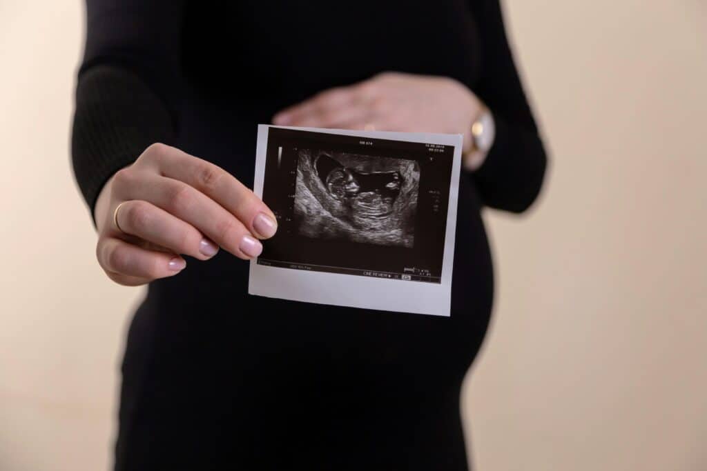 pregnant woman holding ultrasound picture