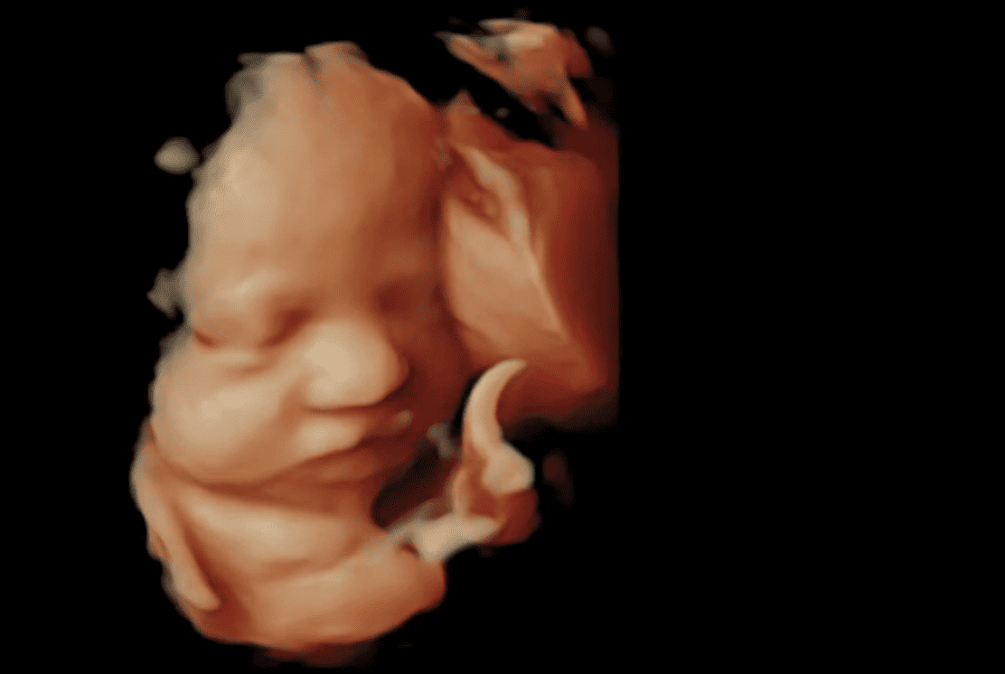 1112px x 746px - The Differences Between 2D, 3D, and 4D Ultrasounds Explained - Focus on the  Family
